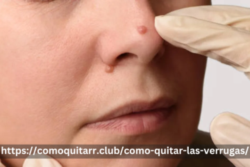 https://comoquitarr.club/como-quitar-las-verrugas/