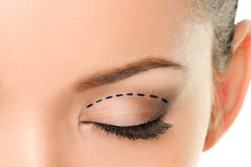 Renown of Upper and Lower Eyelid Surgery in New York City, NY