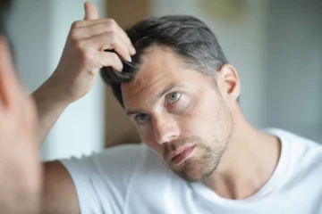 Treating Hair Loss