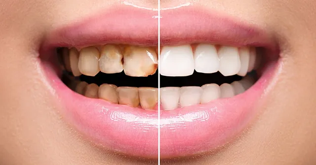 The Perfect Pair: How General And Cosmetic Dentistry Work Together