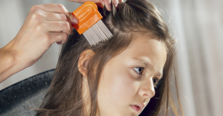 Lice Removal Near Me: Common Problems and Simple Solutions