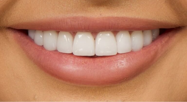 Are Dental Veneers Right for You? A Practical Look at Benefits and Misconceptions