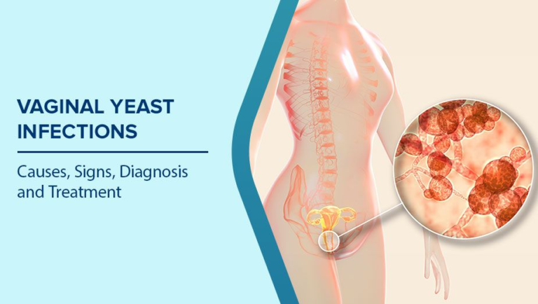 When Discomfort Isn’t ‘Normal’: Common Vaginal Health Issues Explained