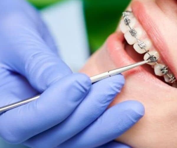 Why More Adults Are Choosing Orthodontic Treatment Today