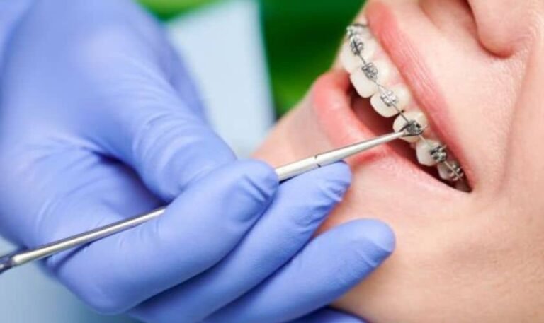 Why More Adults Are Choosing Orthodontic Treatment Today