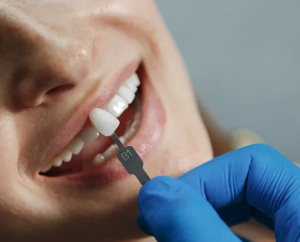 4 Common Myths About Dental Implants Debunked